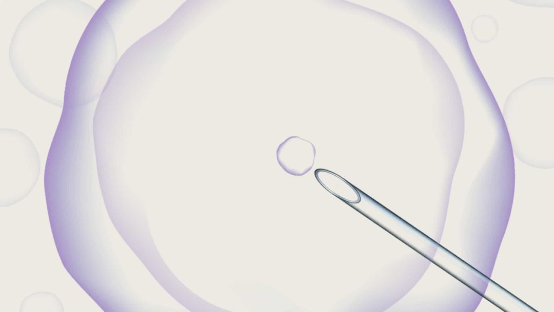 试管婴儿(IVF)流程逐步详解
